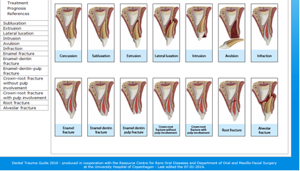 Dental Trauma Guide, 2014 (www.dentaltraumaguide.org)